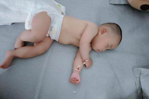 无为宝宝脸上有白色斑块